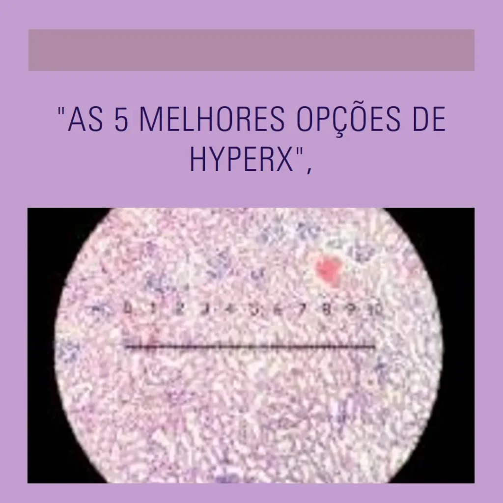 As 5 Melhores Opções de  Hyperx quadcast